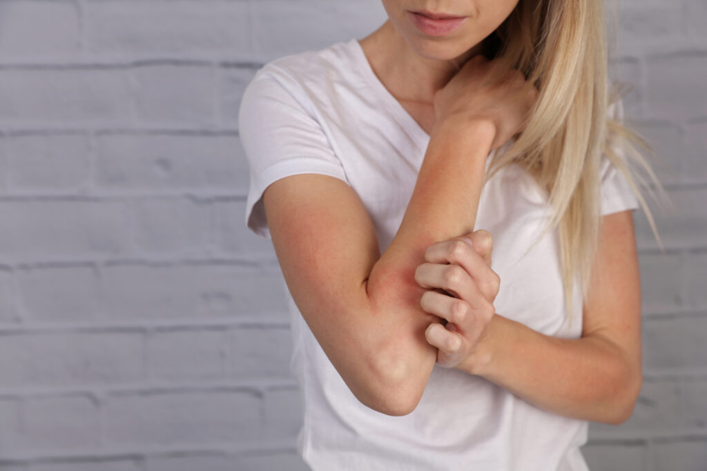 Woman Scratching an itch Sensitive Skin Food allergy symptoms Irritation - Welcome to Vanguard Dermatology - Vanguard Dermatology | Dermatology
